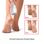 RED BY KISS CORDLESS FOOT CALLUS REMOVER | FCR01