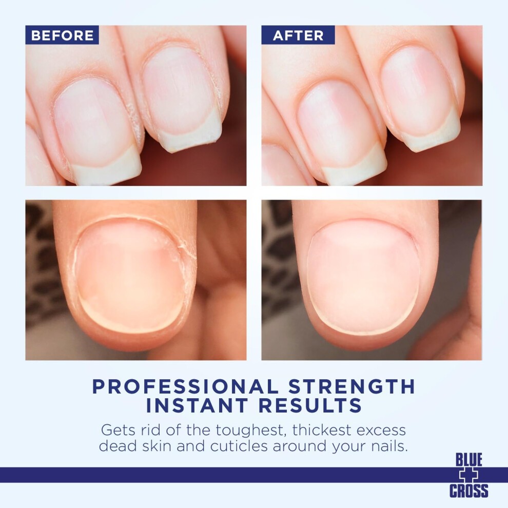Blue Cross Cuticle Remover Liquid Lanolin Enriched
