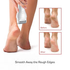 RED BY KISS CORDLESS ELETRIC FOOT CALLUS REMOVER | FCRO1