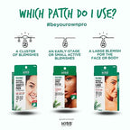 Kiss New York Hydrocolloid Acne Pimple Patch (Hydrocolloid  Tea Tree Oil  CICA) for Zits and Blemishes  Korean Skin Care Spot Treatment Stickers for F